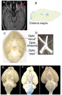 An Experimental Model of Neuromyelitis Optica Spectrum Disorder–Optic Neuritis: Insights Into Disease Mechanisms